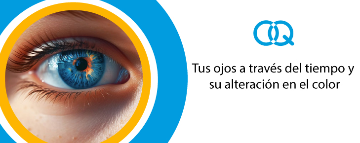 Quantum - ojos alteración en color - Banner